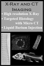 XRay and CT XRay and CT